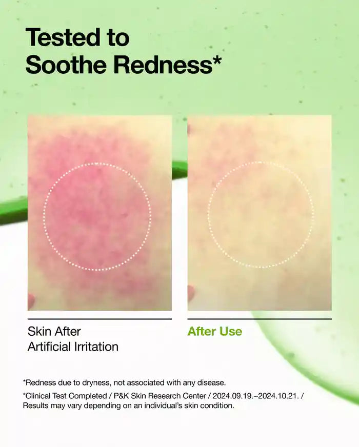 Anua Azelaic Acid 10 Hyaluron Redness Soothing Serum